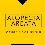 alopecia Areata