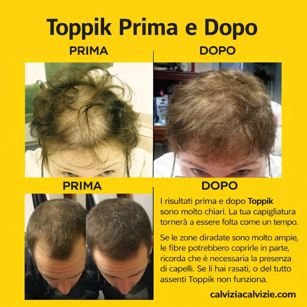 i risultati di toppik