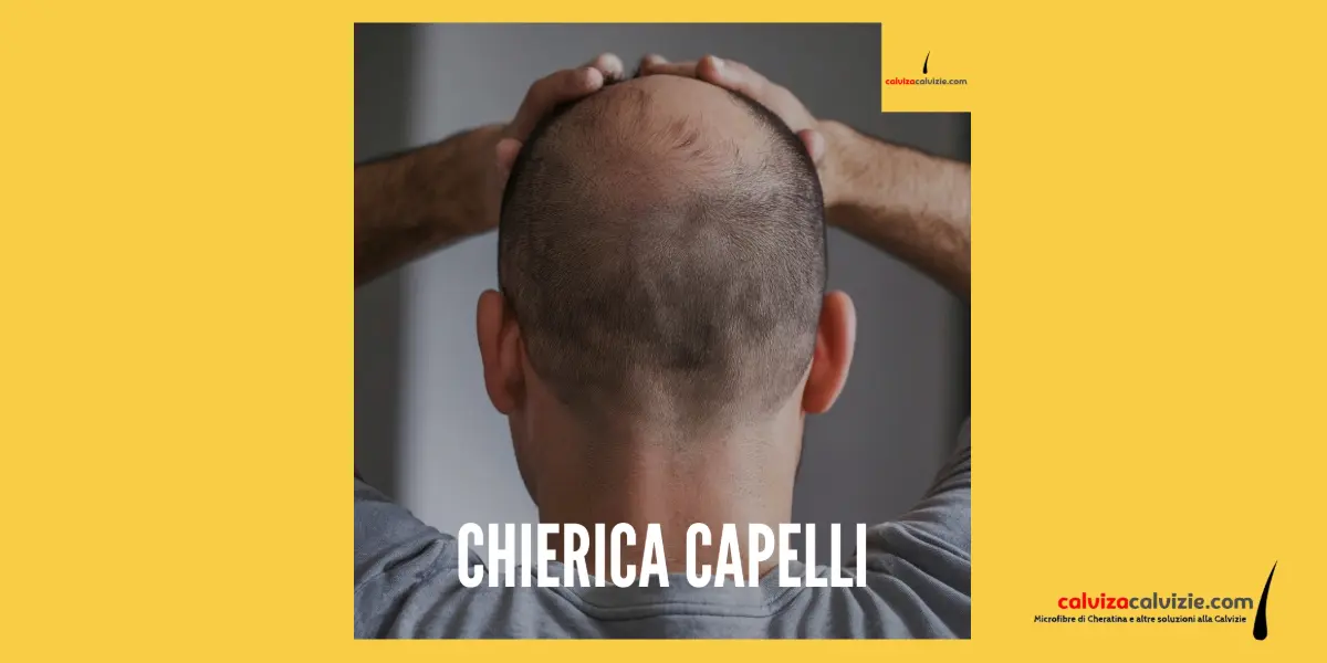 Chierica capelli. Il diradamento sul vertex