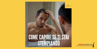 come si fa a capire se si è stempiati