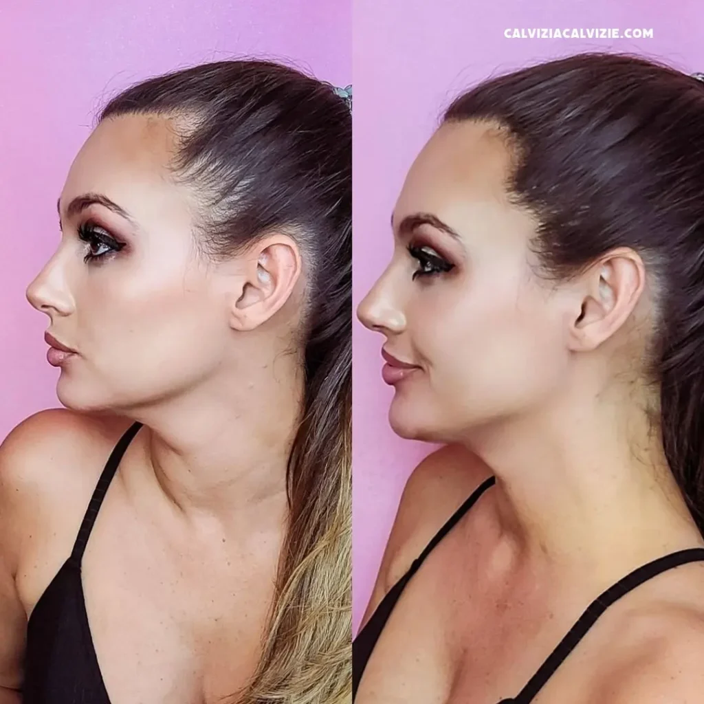 come funziona toppik sui capelli lunghi